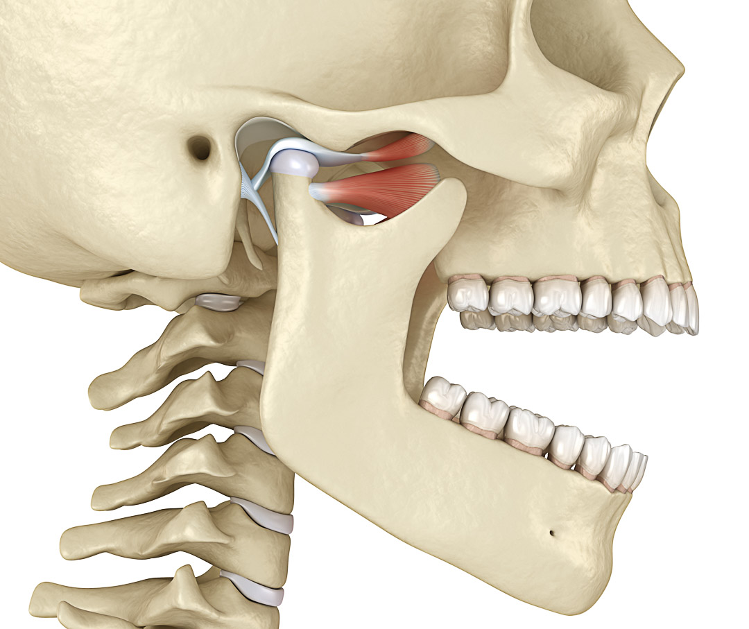 Mandíbula estalando ao abrir e fechar a boca pode ser sinal de disfunção na  ATM (Disfunção Temporomandibular) - Hospital da Face